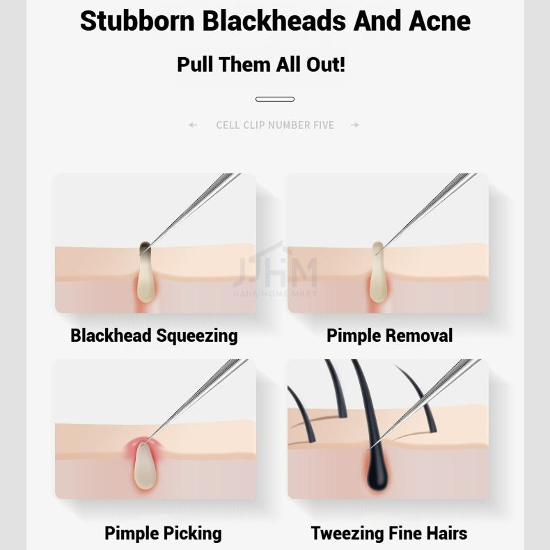 【SG NDD】 Acne Removing Needle Cover Blackhead Removing Tweezers Clip Blackhead Removal Tool Kit,PrecisionTweezers and Pimple Needles for AcneIngrown Hairs, and Skin Care