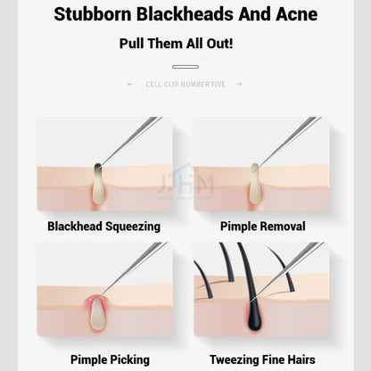 【SG NDD】 Acne Removing Needle Cover Blackhead Removing Tweezers Clip Blackhead Removal Tool Kit,PrecisionTweezers and Pimple Needles for AcneIngrown Hairs, and Skin Care